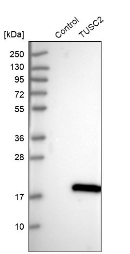 Anti-TUSC2 Antibody
