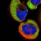 Immunofluorescent staining of human cell line A-431 shows localization to cytosol.