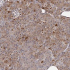 Anti-ANKRD44 Antibody