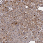 Anti-ANKRD44 Antibody