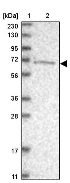 Anti-ANKRD44 Antibody