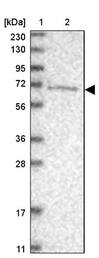 Lane 1: Marker [kDa] 230, 130, 95, 72, 56, 36, 28, 17, 11_br/_Lane 2: Human cell line RT-4