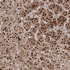 Anti-PPOX Antibody