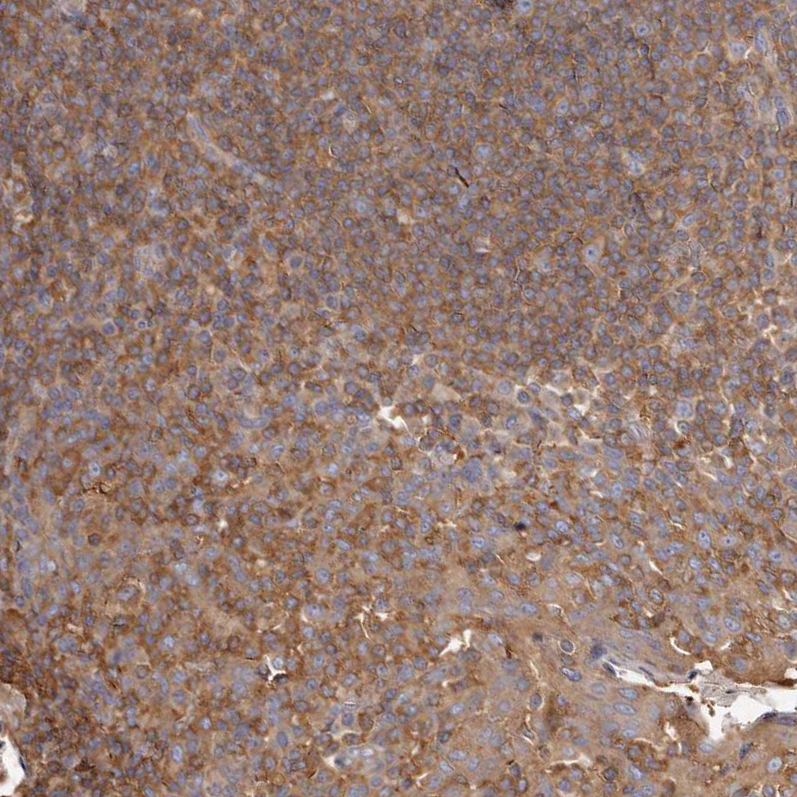 Anti-CAP1 Antibody