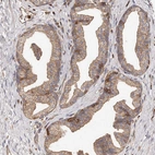 Immunohistochemical staining of human prostate shows moderate cytoplasmic/ membranous positivity in glandular cells.