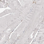 Immunohistochemical staining of human skeletal muscle shows no positivity in myocytes as expected.