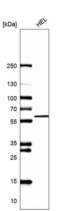 Western blot analysis in human cell line HEL.
