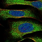 Immunofluorescent staining of human cell line U-2 OS shows localization to cytosol.