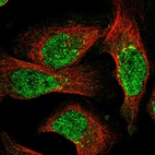 Anti-NUDT18 Antibody