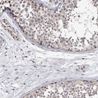Anti-KLHDC3 Antibody