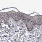 Immunohistochemical staining of human skin shows moderate nuclear positivity in squamous epithelial cells.