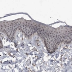 Immunohistochemical staining of human skin shows moderate nuclear positivity in squamous epithelial cells.