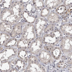Immunohistochemical staining of human kidney shows weak cytoplasmic positivity in cells in tubules.
