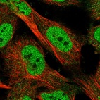 Immunofluorescent staining of human cell line U-251 MG shows localization to nucleoplasm.