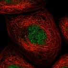 Immunofluorescent staining of human cell line A-431 shows localization to nucleoplasm.