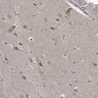 Anti-KLHDC3 Antibody