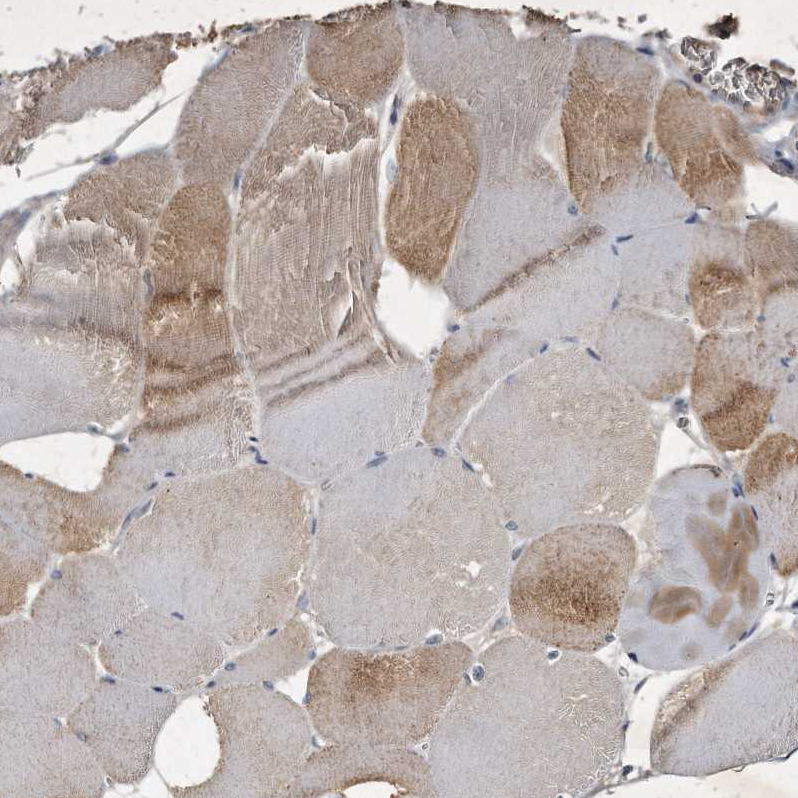 Anti-KLHDC3 Antibody