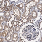 Immunohistochemical staining of human kidney shows weak cytoplasmic positivity in cells in tubules.