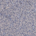 Immunohistochemical staining of human pancreas shows no positivity in exocrine glandular cells as expected.