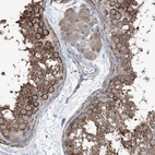 Anti-HSPB11 Antibody