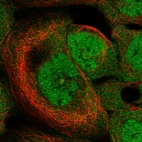 Immunofluorescent staining of human cell line A-431 shows localization to nucleoplasm & cytosol.