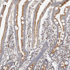 Anti-IQGAP3 Antibody