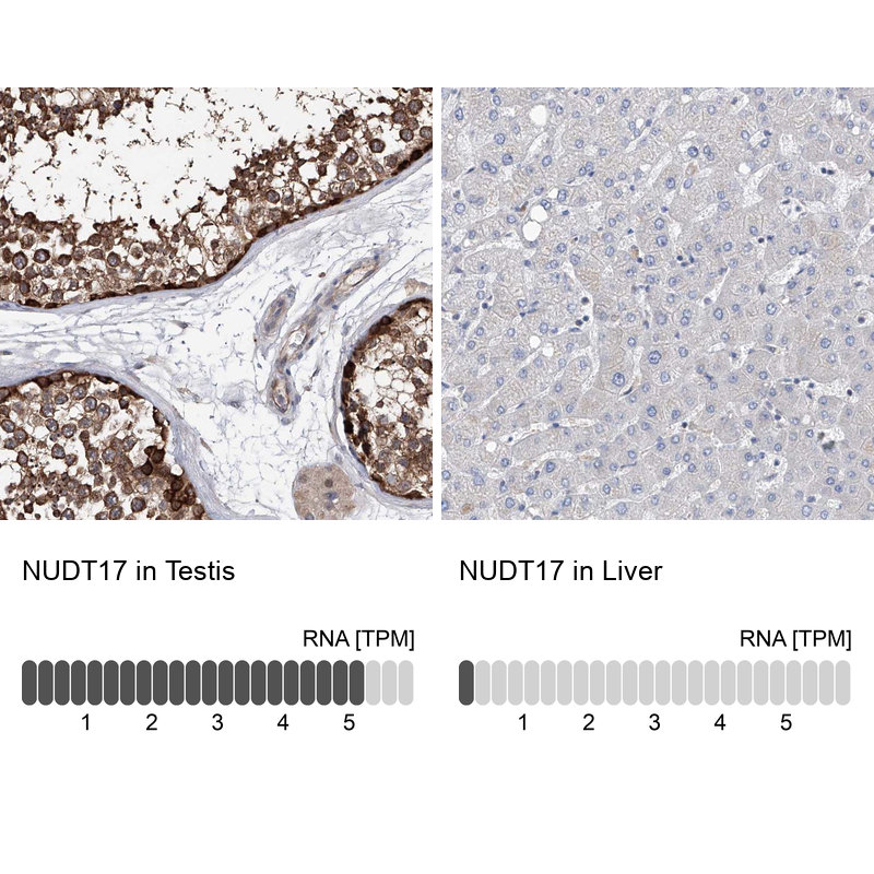 Anti-NUDT17 Antibody