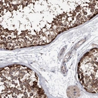 Immunohistochemical staining of human testis shows high expression.