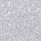 Immunohistochemical staining of human liver shows low expression as expected.