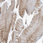 Immunohistochemical staining of human skeletal muscle shows weak cytoplasmic positivity in myocytes.