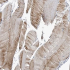 Immunohistochemical staining of human skeletal muscle shows weak cytoplasmic positivity in myocytes.