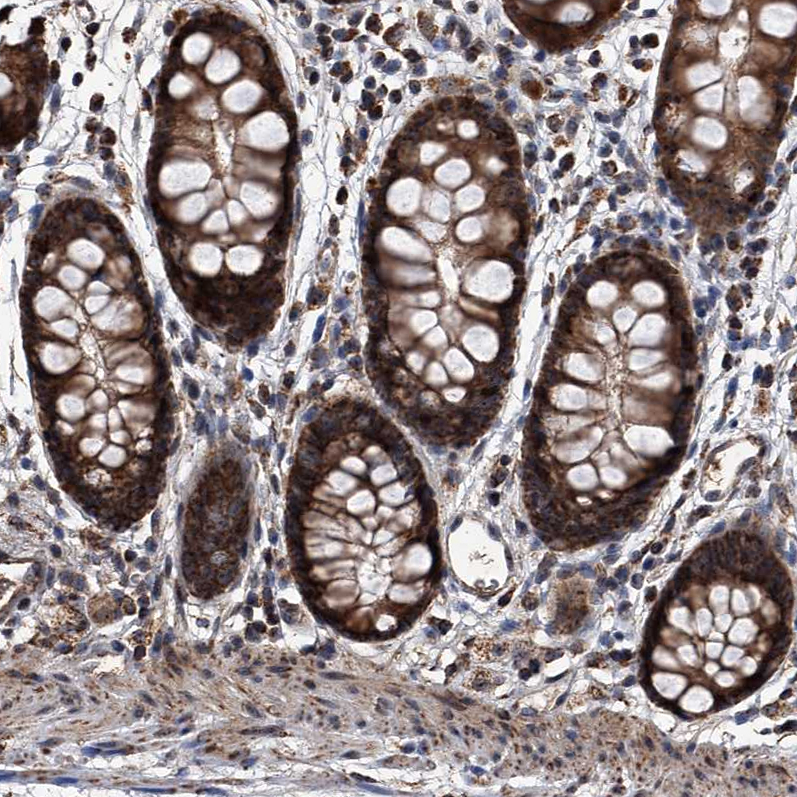Anti-SMPDL3A Antibody