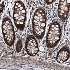 Anti-SMPDL3A Antibody