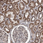 Immunohistochemical staining of human kidney shows strong cytoplasmic granular positivity in cells in tubules.