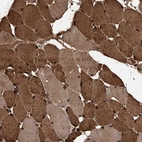 Immunohistochemical staining of human skeletal muscle shows strong cytoplasmic positivity in myocytes.