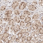 Anti-RFC3 Antibody