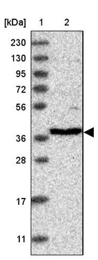 Anti-RFC3 Antibody