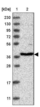 Lane 1: Marker [kDa] 230, 130, 95, 72, 56, 36, 28, 17, 11_br/_Lane 2: Human cell line RT-4