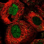 Immunofluorescent staining of human cell line A-431 shows localization to nucleoplasm & vesicles.