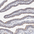 Anti-LACE1 Antibody