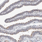Anti-LACE1 Antibody