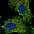 Immunofluorescent staining of human cell line U-2 OS shows localization to plasma membrane & cytosol.