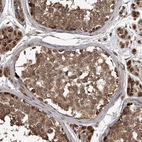 Anti-LTV1 Antibody