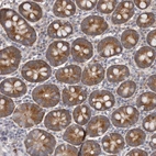 Immunohistochemical staining of human duodenum shows moderate cytoplasmic positivity in glandular cells.