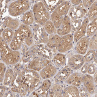 Immunohistochemical staining of human kidney shows moderate cytoplasmic positivity in cells in tubules.