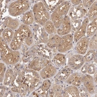 Immunohistochemical staining of human kidney shows moderate cytoplasmic positivity in cells in tubules.