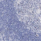 Immunohistochemical staining of human lymph node using Anti-FRS3 antibody HPA030162.