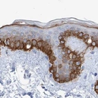 Immunohistochemical staining of human skin using Anti-FRS3 antibody HPA030162.