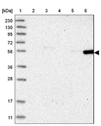 Lane 1: Marker [kDa] 230, 130, 95, 72, 56, 36, 28, 17, 11_br/_Lane 2: Human cell line RT-4_br/_Lane 3: Human cell line U-251MG sp_br/_Lane 4: Human plasma (IgG/HSA depleted)_br/_Lane 5: Human liver tissue_br/_Lane 6: Human tonsil tissue