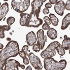 Immunohistochemical staining of human placenta shows strong cytoplasmic granular positivity in trophoblastic cells.